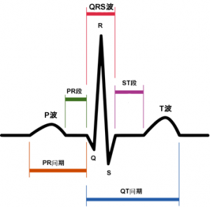 心电图波型